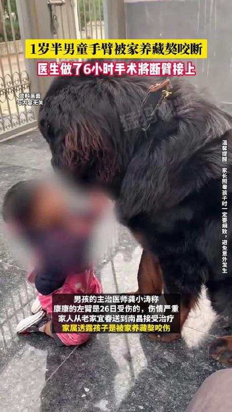 藏獒咬小女孩！谁来守护孩子安全？