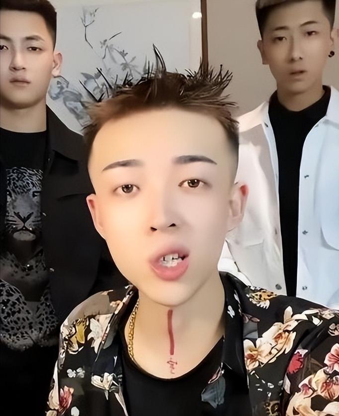 宇将军与狗磊冲突：挑虾线事件深度解读