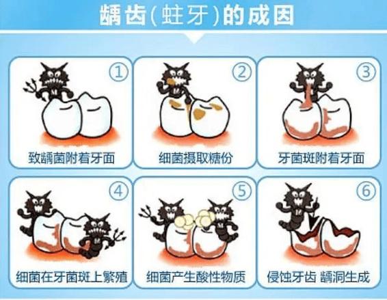 蚂蚁庄园问答龋齿：宝宝牙齿健康你关心了吗？