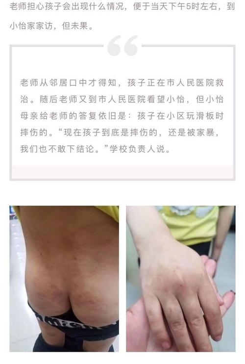 河源7岁女童隐私部位受伤：令人震惊的细节