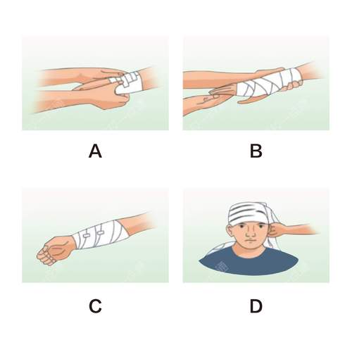 绷带怎么选才对？教你几招快速挑选最合适！