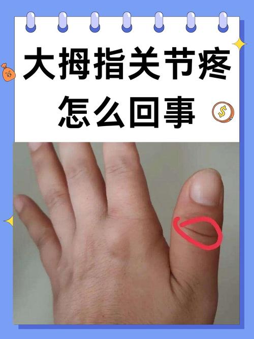 为什么大拇指是两节手指？揭秘这个结构带来的3个优势