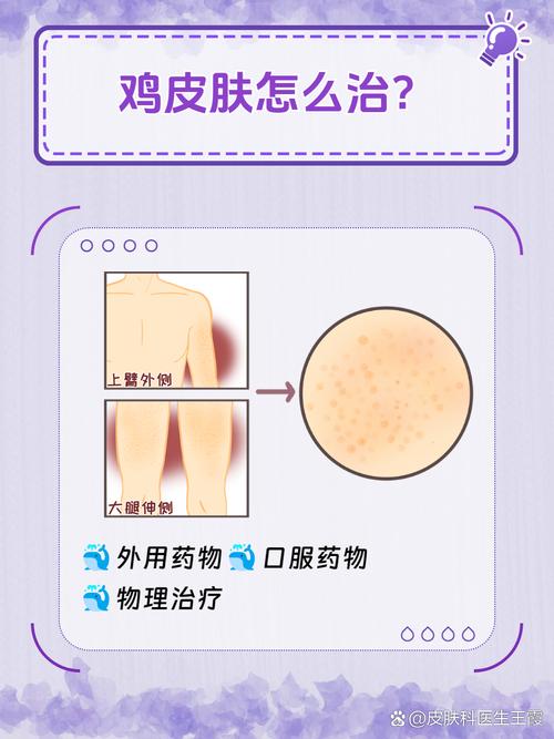 身体起鸡皮疙瘩咋回事？科学解释这奇怪现象