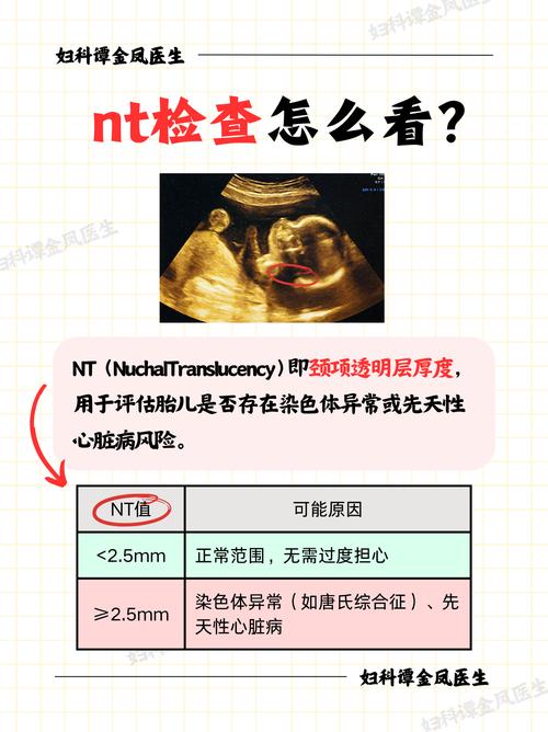 ntlea常见问题？快速解决步骤一网打尽