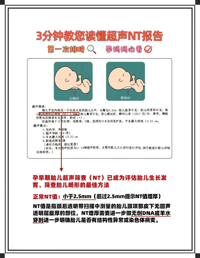 ntlea常见问题？快速解决步骤一网打尽