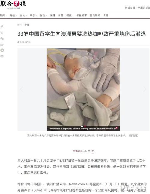 热咖啡事件法律责任（资深顾问指路维权步骤）