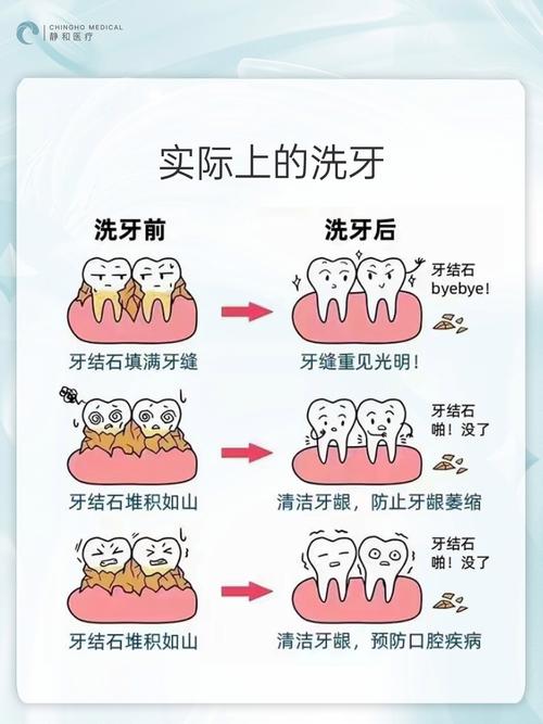 洗牙蚂蚁庄园操作步骤详解(新手轻松上手指南分享)