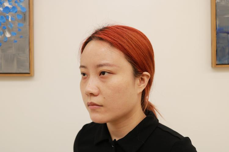 瞳孔长方形能恢复吗？3招教你改善眼部健康状况