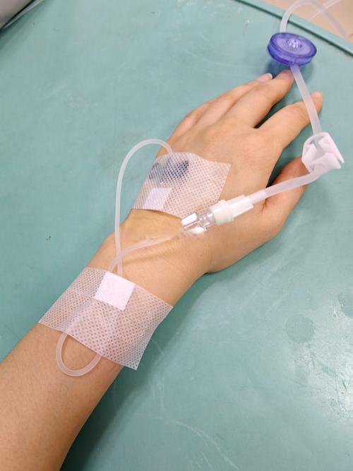 输的什么液效果怎么样？真实体验心得分享