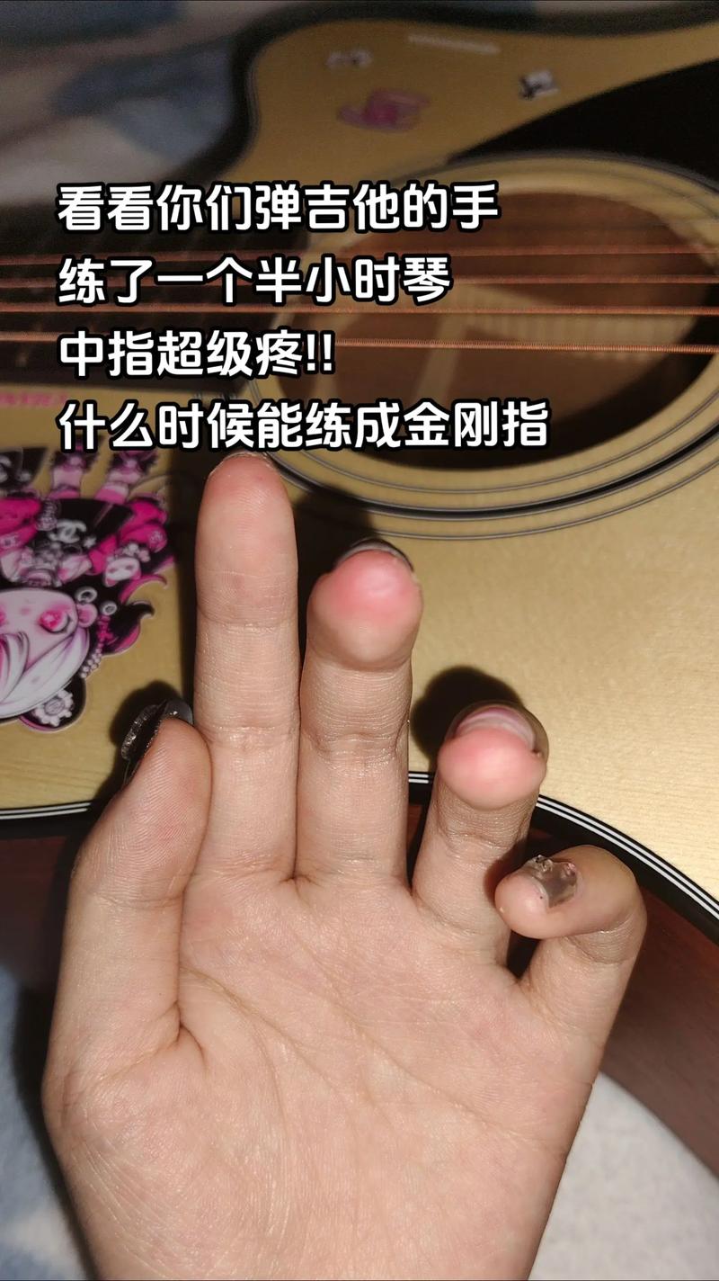 吉他英雄怎么玩练拇指?弹奏必学手部技巧教学