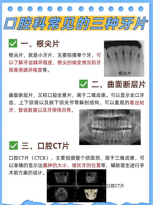 影牙多少级能进常见问题（一次搞懂所有等级要求）