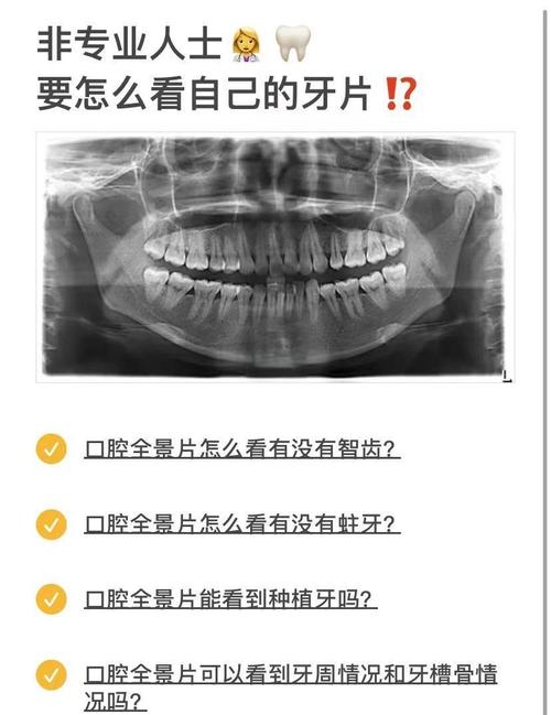 影牙多少级能进常见问题（一次搞懂所有等级要求）