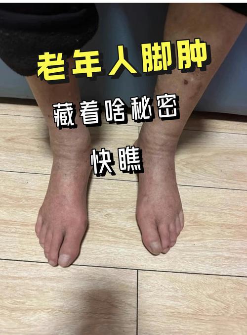 大脚无法更新是什么原因？排查常见问题的5个方法