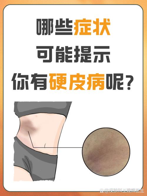 硬甲皮哪里搞最多？热门地图隐藏刷点别错过