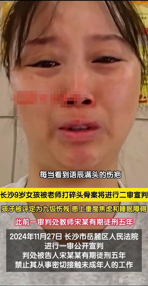 颜艳红虐童事件最新进展?追踪动态与影响分析!