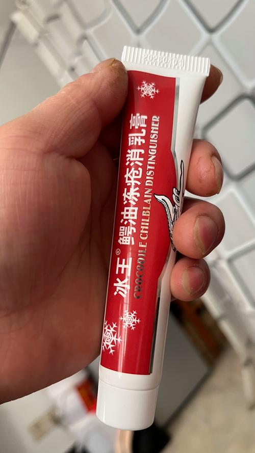 wow冻伤用什么药好？实测推荐这几款有效药物！