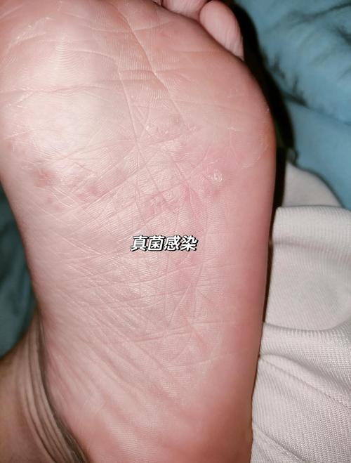 真菌世界秘籍效果如何评测(真实玩家体验大揭秘分享)