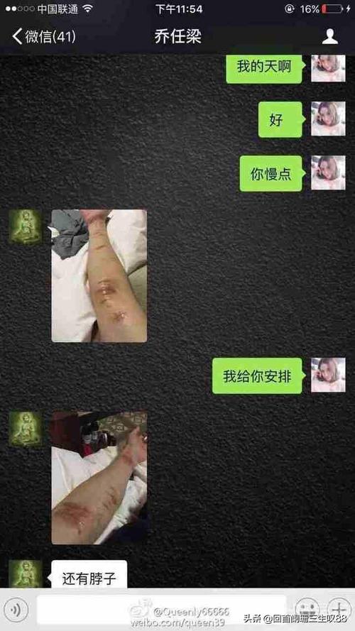 为什么胳膊丢了还能活？医生揭秘背后的真相！