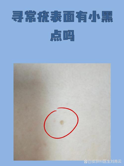 微小的我最新版本：深度分析与未来展望