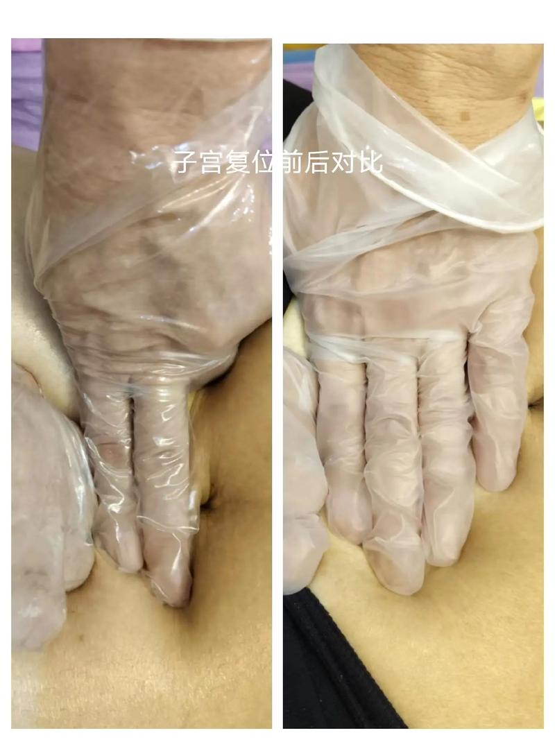 揭秘《太太的恢复术：夺爱篇》的更新与发展趋势