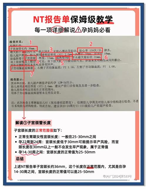 深度解析《编年史NTR》完结版汉化版的最新更新内容