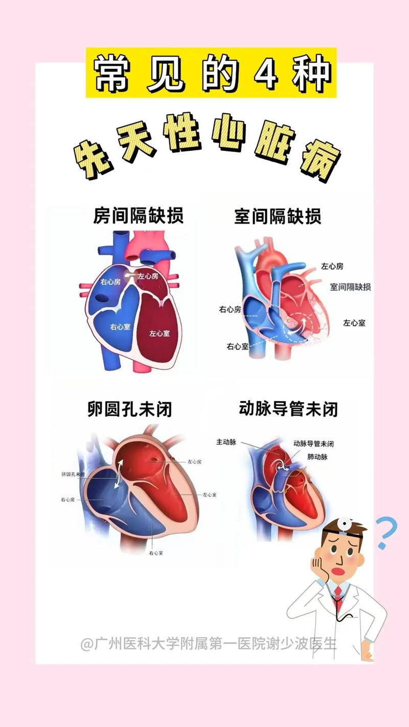 心脏问题版本大全：全面教程与解决方案