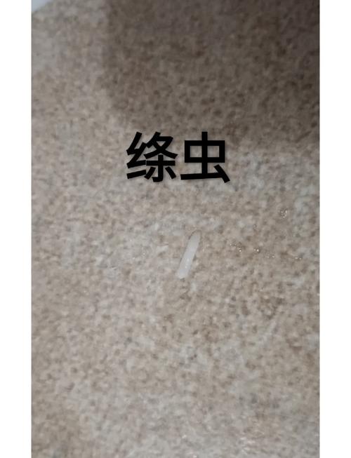 内部寄生虫最新版本的深度解析与应用前景