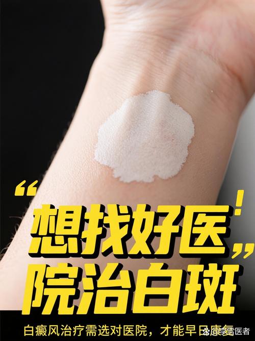 在哪里能找到靠谱的白嫖券下载地址并且不被坑